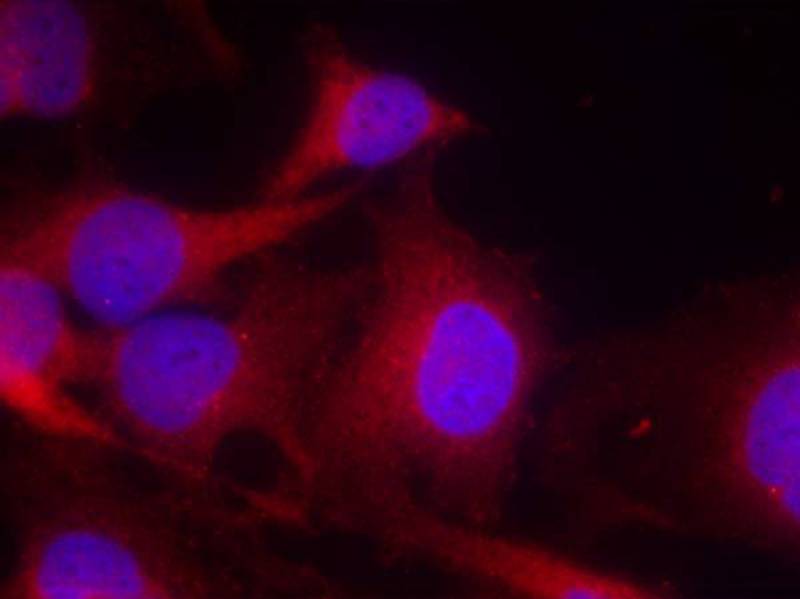 PLCg2(Ab-753) Antibody