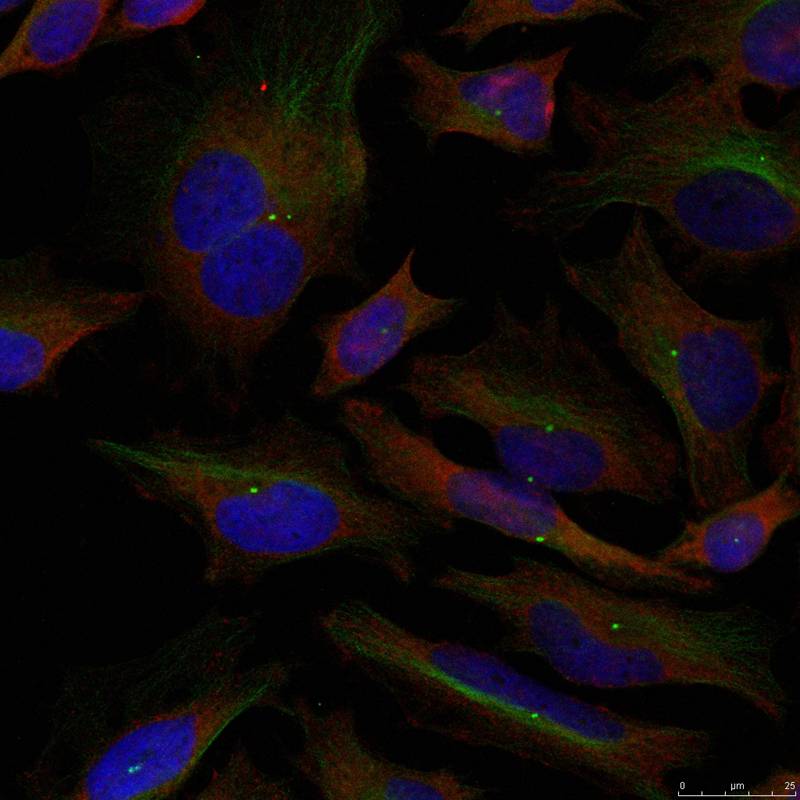 ADD1(Ab-726) Antibody