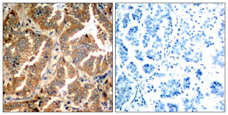 ADD1(Ab-726) Antibody