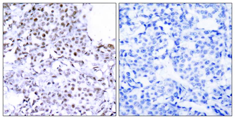 SMC1(Ab-957) Antibody