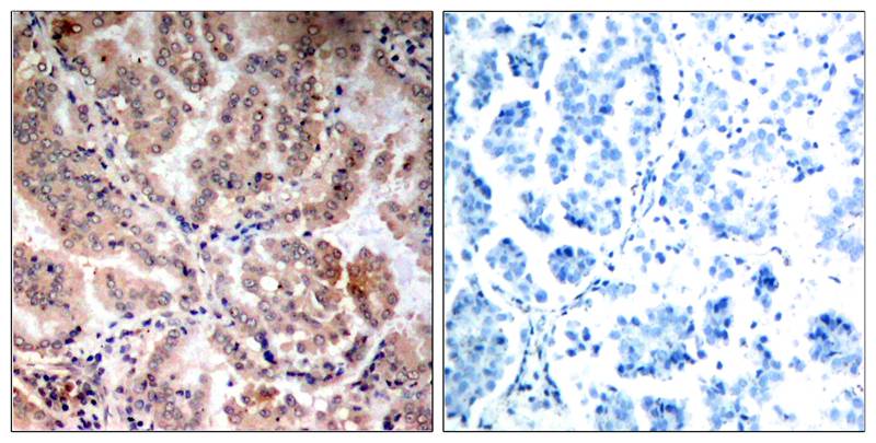 AMPKα1/AMPKα2 (Ab-183/172) Antibody