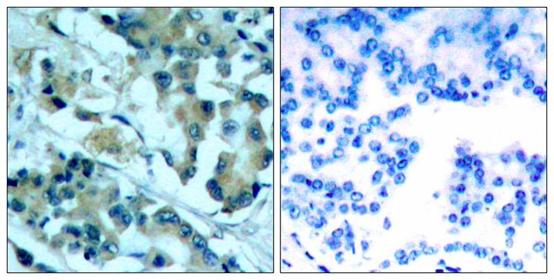 MEK1/MEK2(Ab-217/221) Antibody