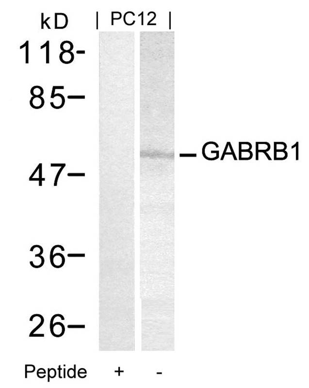 GABRB1(Ab-434) Antibody