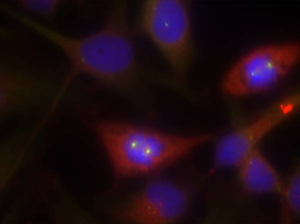 b-Catenin(Ab-33) Antibody