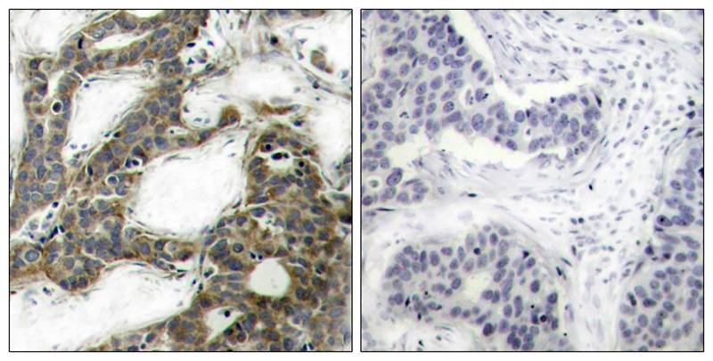 b-Catenin(Ab-33) Antibody