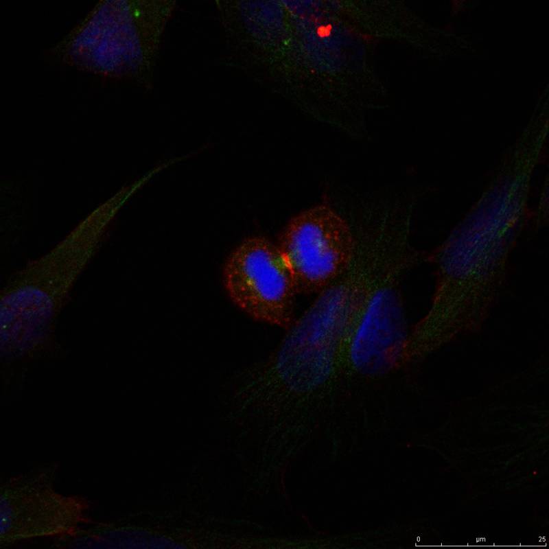 b-Catenin(Ab-37) Antibody