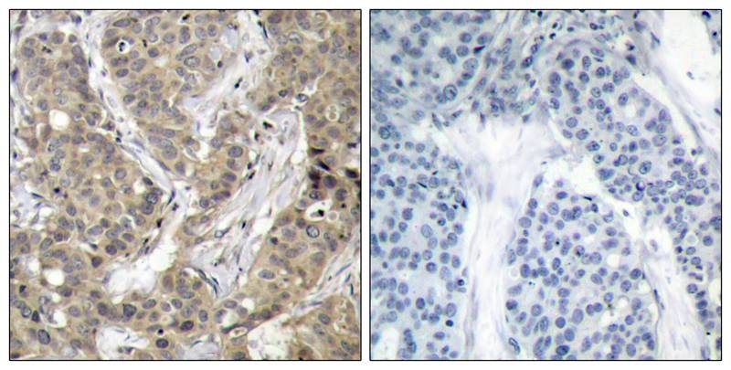 b-Catenin(Ab-37) Antibody