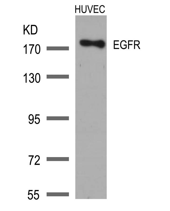 EGFR(Ab-1172) Antibody