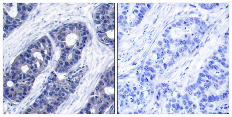 IRS-1(Ab-636) Antibody