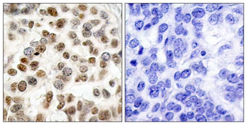 BRCA1(Ab-1423) Antibody