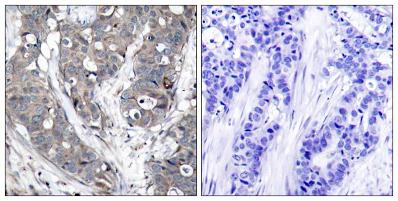 HSP27(Ab-78) Antibody