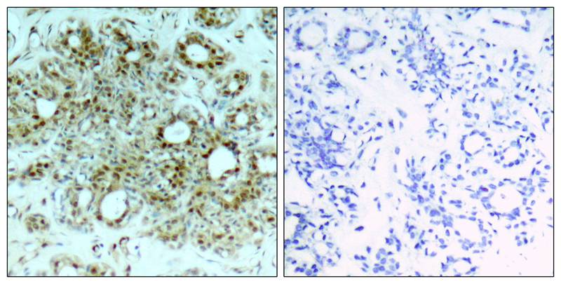 NFkB-p65(Ab-311) Antibody