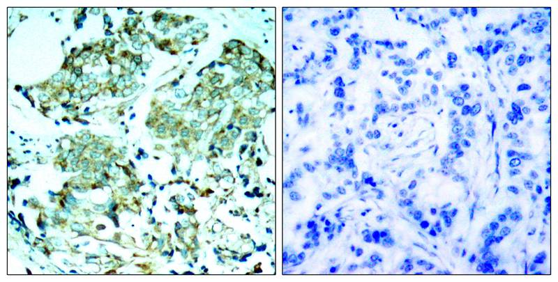 EGFR(Ab-1110) Antibody