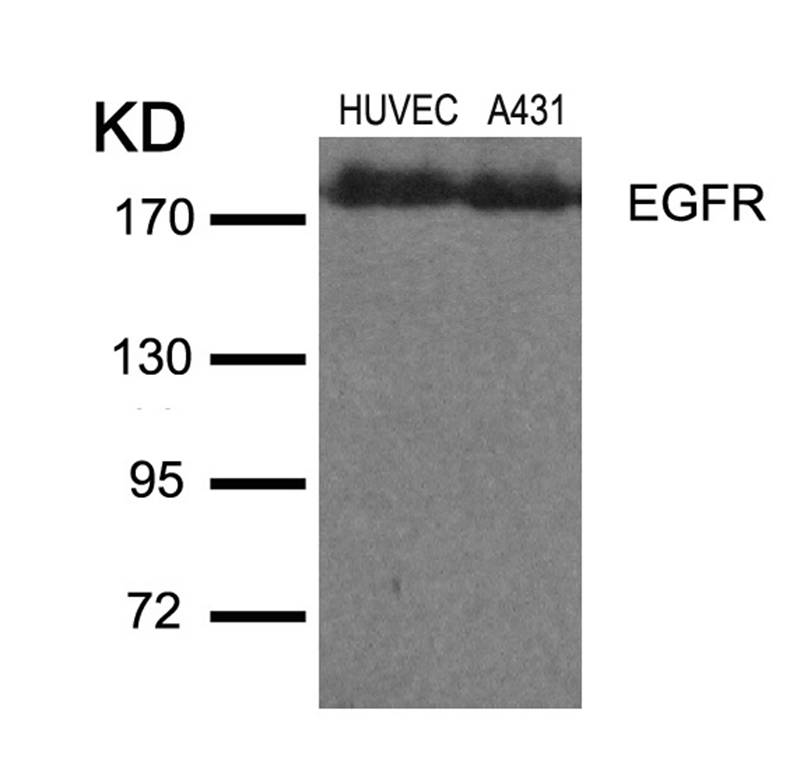 EGFR(Ab-1110) Antibody