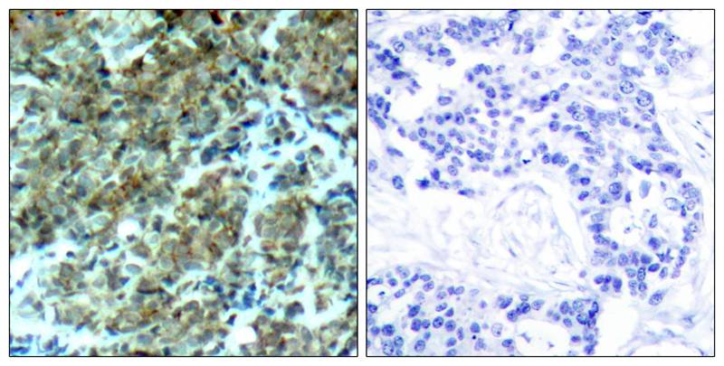 Cortactin(Ab-466) Antibody