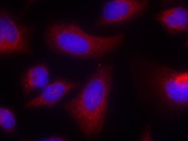 p70 S6 Kinase(Ab-424) Antibody