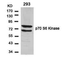 p70 S6 Kinase(Ab-424) Antibody
