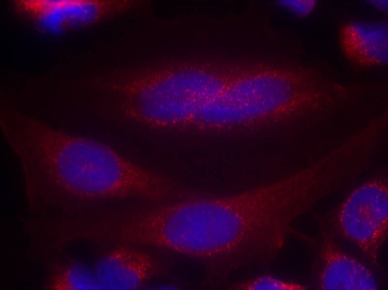 a-Synuclein(Ab-133) Antibody