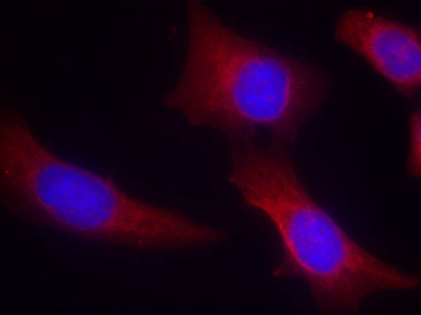 CaMKII(Ab-286) Antibody