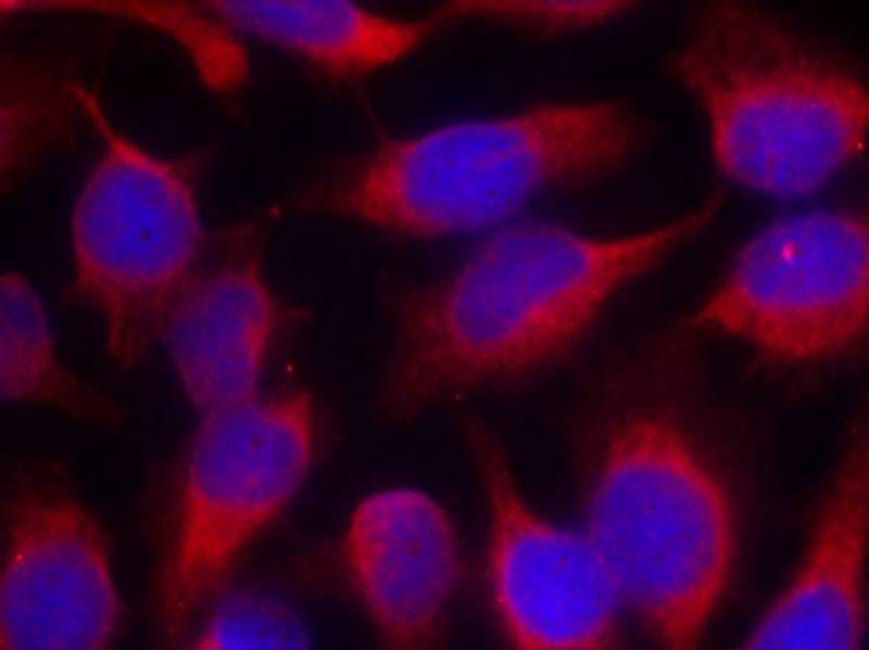 MARCKS(Ab-158) Antibody