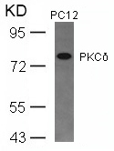 PKCd(Ab-645) Antibody