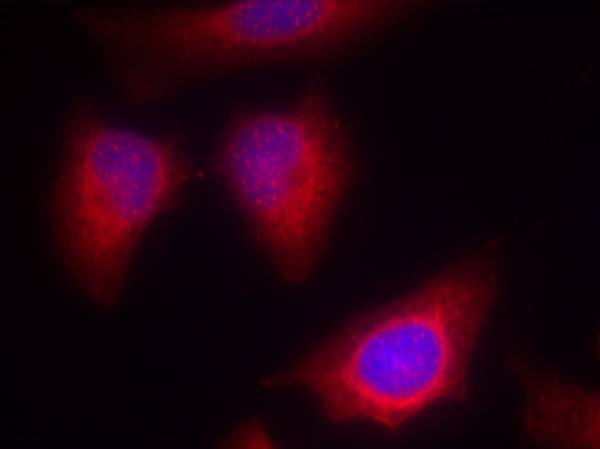 PKCth(Ab-676) Antibody