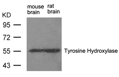 Tyrosine Hydroxylase(Ab-31) Antibody