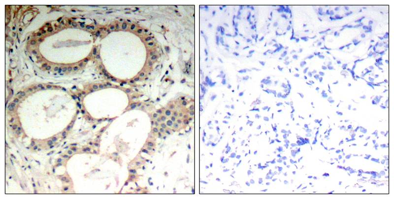IkB-e(Ab-22) Antibody