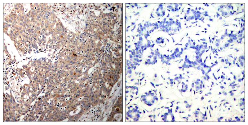 Keratin 18(Ab-33) Antibody