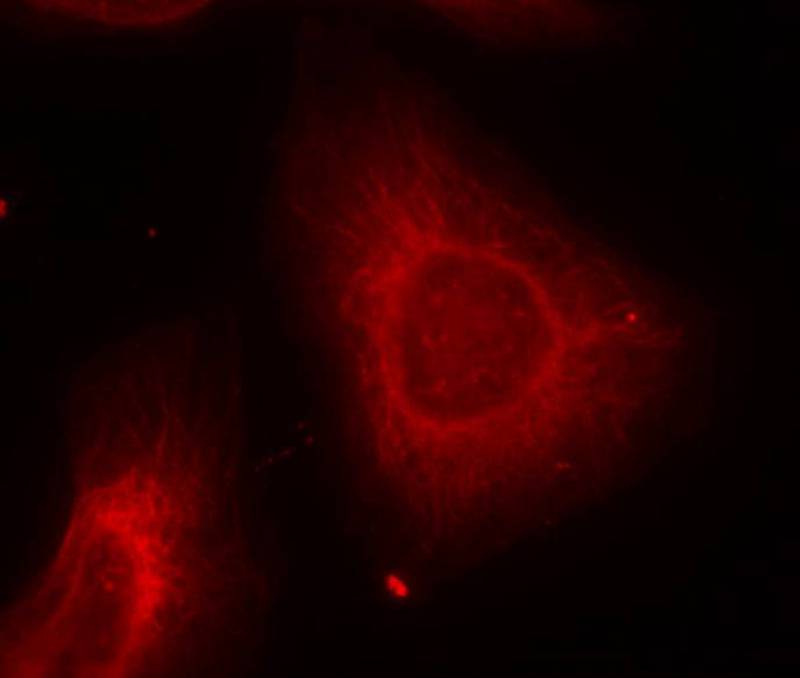 Keratin 8(Ab-74) Antibody