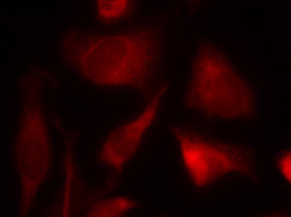 Smad2(Ab-467) Antibody