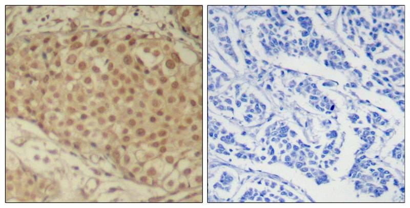 Smad2(Ab-220) Antibody