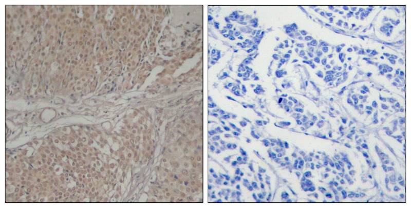 Smad3(Ab-208) Antibody