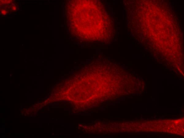 Smad3(Ab-425) Antibody