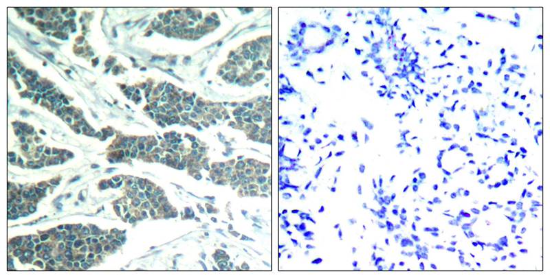 AKT1/AKT2/AKT3(Ab-315/316/312) Antibody