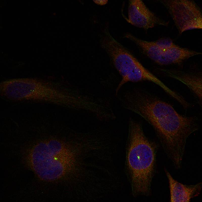 cofilin1/cofilin2(Ab-88) Antibody