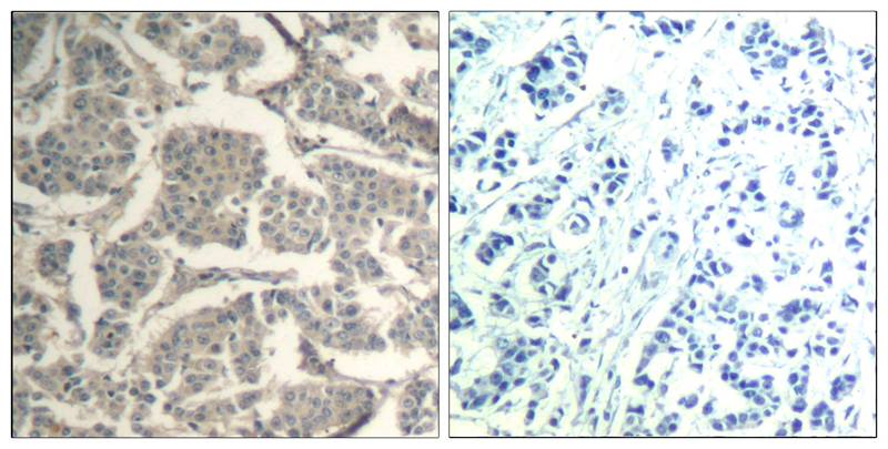 cofilin1/cofilin2(Ab-88) Antibody