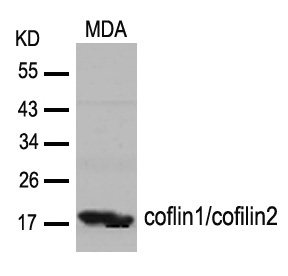 cofilin1/cofilin2(Ab-88) Antibody