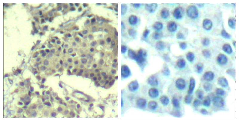 mTOR(Ab-2481) Antibody