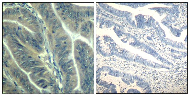 CDK6(Ab-24) Antibody