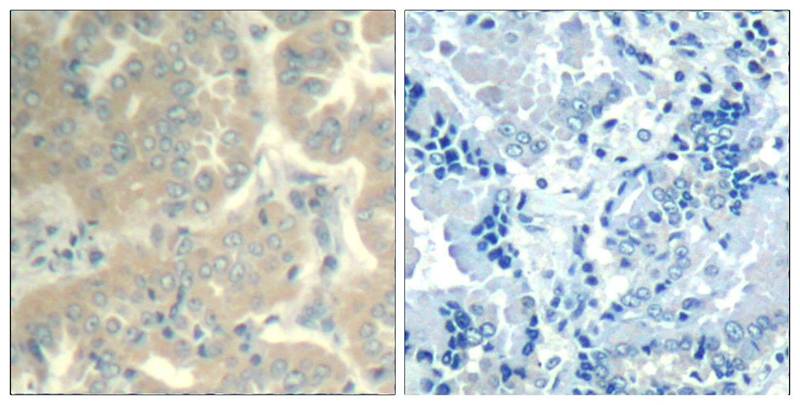 FAK(Ab-576/577) Antibody