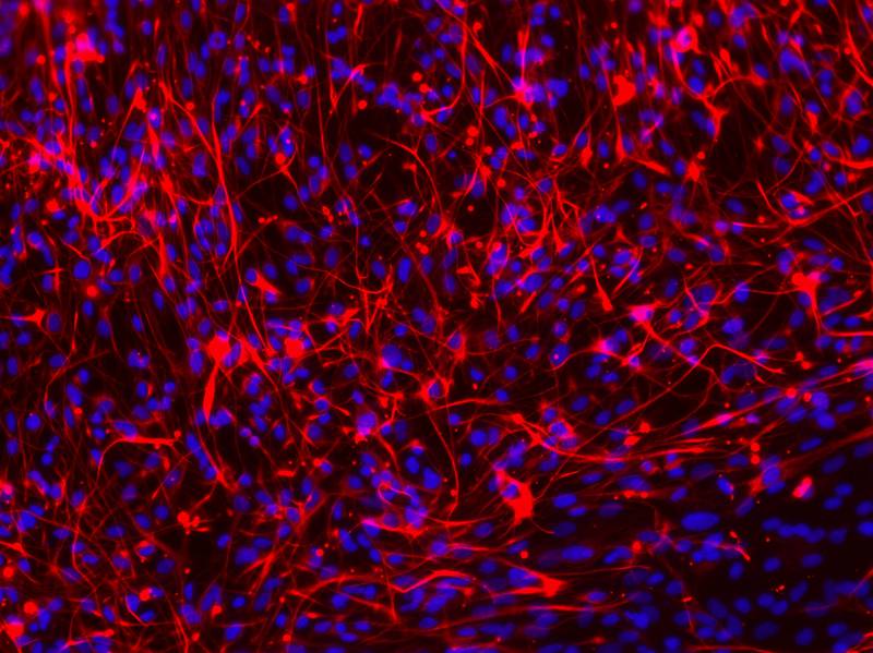 MAP2 Antibody