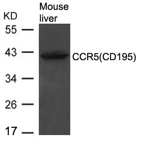 CCR5(CD195) Antibody