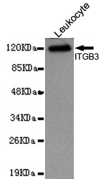 Integrin beta 3(N-terminus) Monoclonal Antibody - SAB | Signalway Antibody