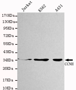 CCNH Monoclonal Antibody