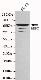 EEF2 Monoclonal Antibody