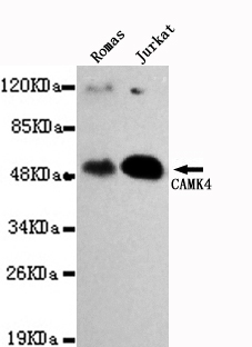 CAMK4 Monoclonal Antibody