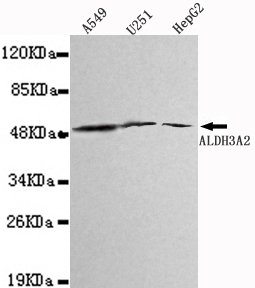 ALDH3A2 Monoclonal Antibody