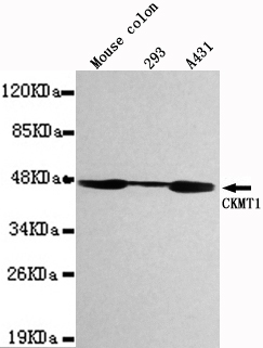 CKMT1 Monoclonal Antibody