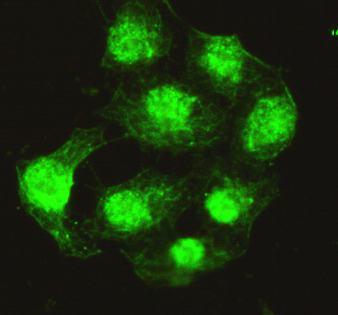 Protein Phosphatase 4C Monoclonal Antibody